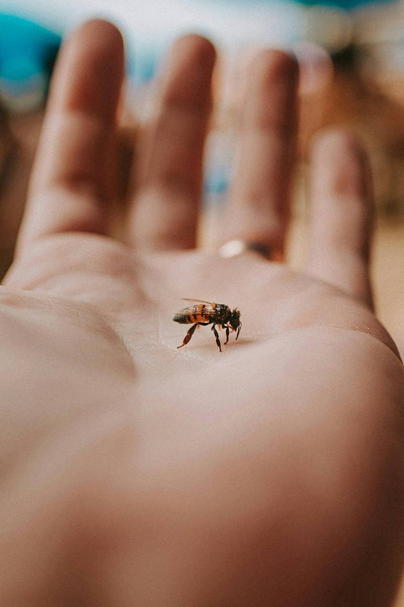 bee sting on childs hand