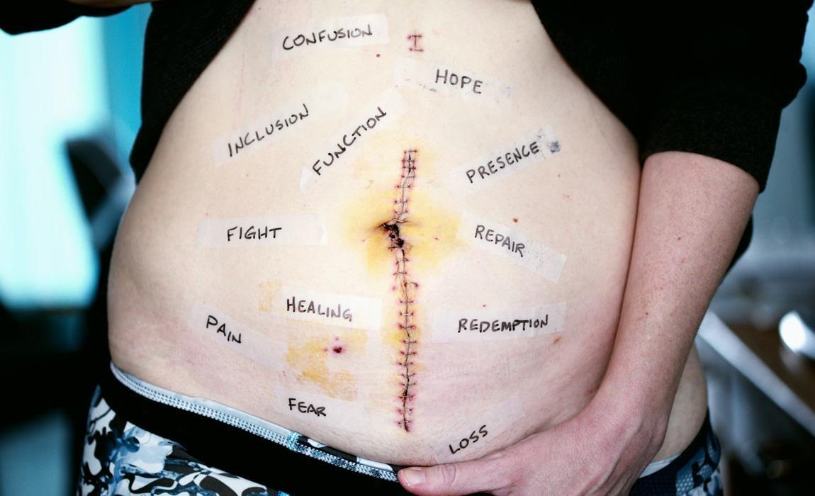 how men can handle embarrassing medical conditions
